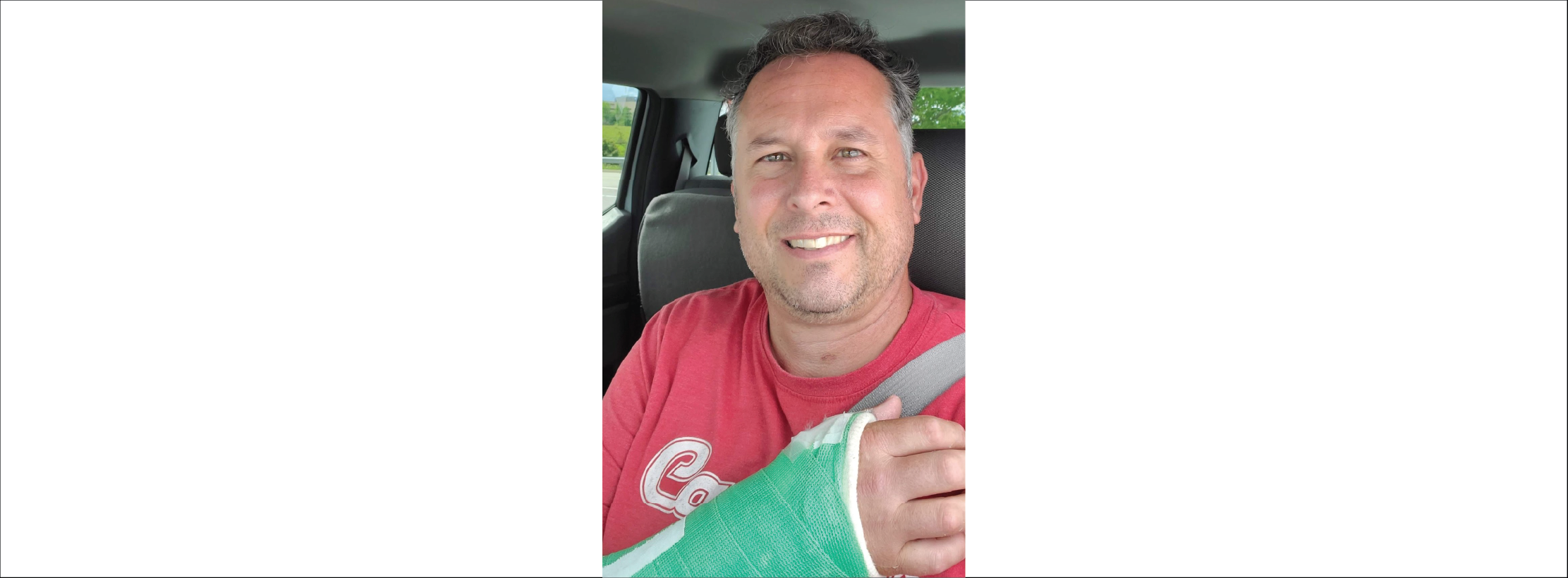 un homme en t-shirt rouge avec un plâtre vert sur le bras