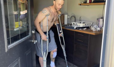 Scott walking in his home with crutches.